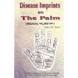 Disease imprints palm for sale  Delivered anywhere in USA 