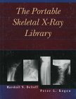 Portable skeletal x for sale  Delivered anywhere in USA 