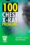100 chest ray d'occasion  Livré partout en France