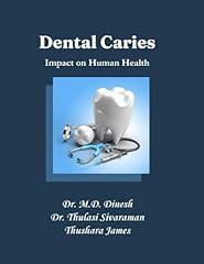 Dental caries impact usato  Spedito ovunque in Italia 