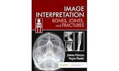 Image interpretation bones for sale  Delivered anywhere in Ireland