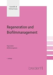 Regeneration biofilmmanagement gebraucht kaufen  Wird an jeden Ort in Deutschland