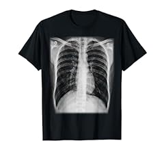 Skeleton chest ray for sale  Delivered anywhere in USA 
