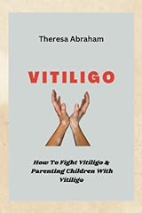 Vitiligo how fight d'occasion  Livré partout en France