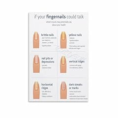 Nails healthconditions poster for sale  Delivered anywhere in USA 