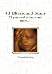 Ultrasound scans need for sale  Delivered anywhere in USA 