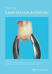 Zahntransplantation biologisch d'occasion  Livré partout en France