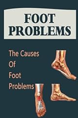 Foot problems causes for sale  Delivered anywhere in Ireland