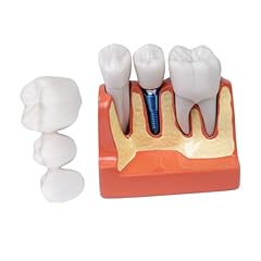 Sarini modello dente usato  Spedito ovunque in Italia 