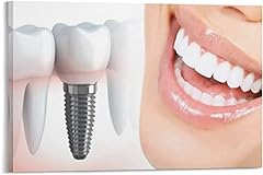 Art dental implants for sale  Delivered anywhere in USA 