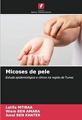 Micoses pele estudo gebraucht kaufen  Wird an jeden Ort in Deutschland