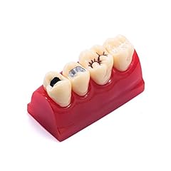 Dental pathology teeth for sale  Delivered anywhere in USA 