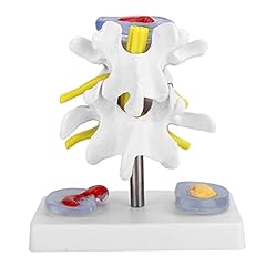 Anatomical lumbar disc for sale  Delivered anywhere in Ireland