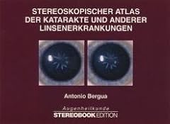 Stereoskopischer atlas katarak gebraucht kaufen  Wird an jeden Ort in Deutschland