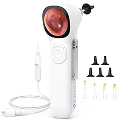Scopearound digital otoscope for sale  Delivered anywhere in USA 