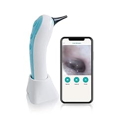 Wireless otoscope ear for sale  Delivered anywhere in USA 