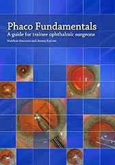 Phaco fundamentals guide gebraucht kaufen  Wird an jeden Ort in Deutschland