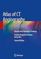 Atlas angiography normal for sale  Delivered anywhere in USA 