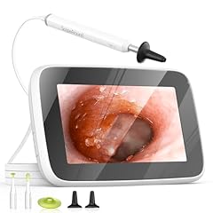 Scopearound digital otoscope for sale  Delivered anywhere in USA 
