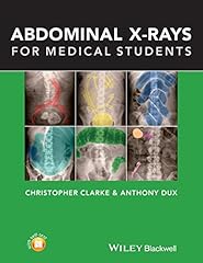 Abdominal rays for d'occasion  Livré partout en Belgiqu