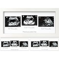Keababies baby sonogram for sale  Delivered anywhere in USA 