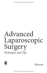 Advanced laparoscopic surgery for sale  Delivered anywhere in UK