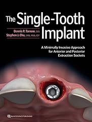 Single tooth implant for sale  Delivered anywhere in USA 