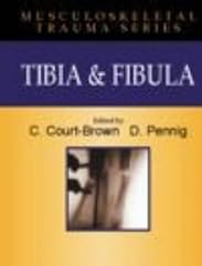 Tibia fibia tibia for sale  Delivered anywhere in UK