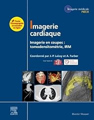 Imagerie cardiaque imagerie d'occasion  Livré partout en Belgiqu