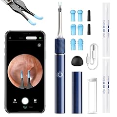 Otoscope oreille1080p otoscope d'occasion  Livré partout en France