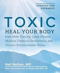 Toxic 2nd edition for sale  Delivered anywhere in USA 