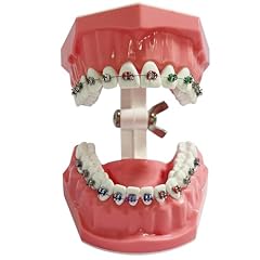 Orthodontic dental model for sale  Delivered anywhere in USA 