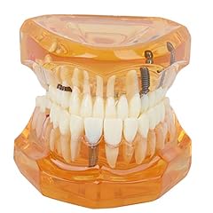 Dental education models for sale  Delivered anywhere in UK