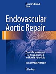 Endovascular aortic repair for sale  Delivered anywhere in USA 