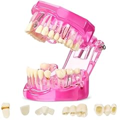 Outus disease teeth for sale  Delivered anywhere in USA 