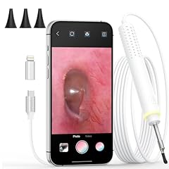 Otoscope iphone android for sale  Delivered anywhere in USA 