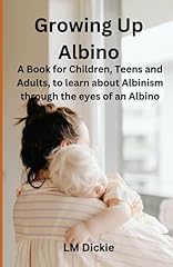 Growing albino book for sale  Delivered anywhere in UK