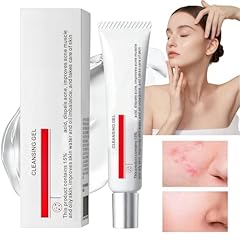 Acid acne treatment for sale  Delivered anywhere in UK