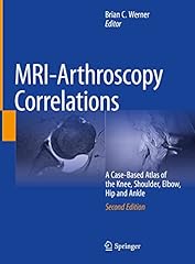 Mri arthroscopy correlations for sale  Delivered anywhere in USA 