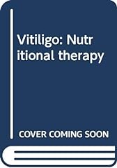 Vitiligo nutritional therapy d'occasion  Livré partout en France