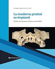 Moderna protesi impianti. usato  Spedito ovunque in Italia 