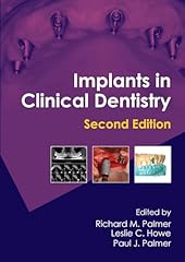 Implants clinical dentistry gebraucht kaufen  Wird an jeden Ort in Deutschland