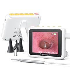 Scopearound otoscope light for sale  Delivered anywhere in USA 