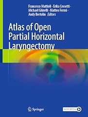 Atlas open partial for sale  Delivered anywhere in USA 