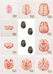 Pieces anatomic brain for sale  Delivered anywhere in USA 