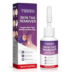 Wart remover wart for sale  Delivered anywhere in UK