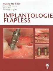Implantologie flapless d'occasion  Livré partout en Belgiqu
