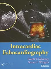 Intracardiac echocardiography d'occasion  Livré partout en France