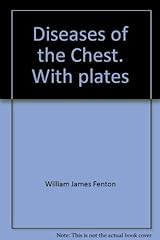 Diseases chest. plates for sale  Delivered anywhere in UK