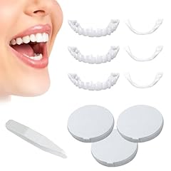 Zahnprothese veneers zähne gebraucht kaufen  Wird an jeden Ort in Deutschland